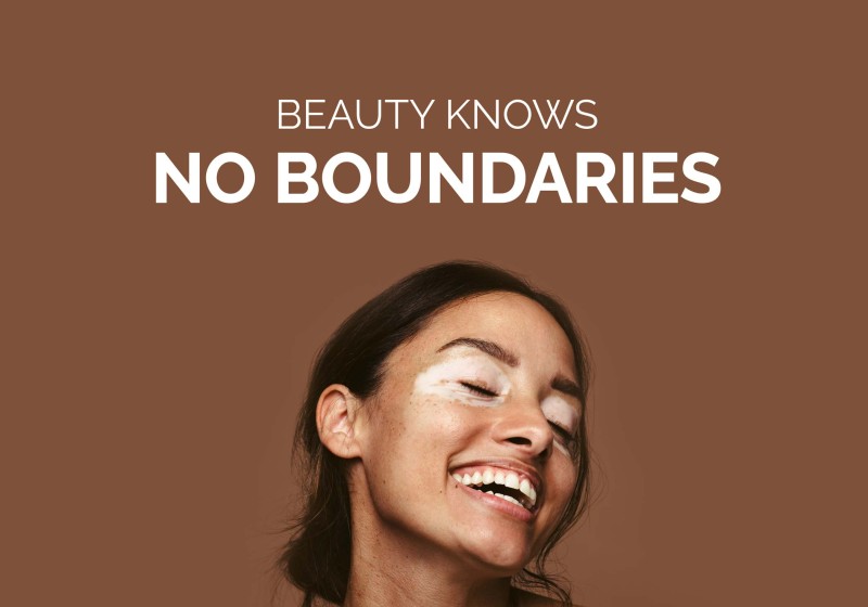 No boundaries hero image