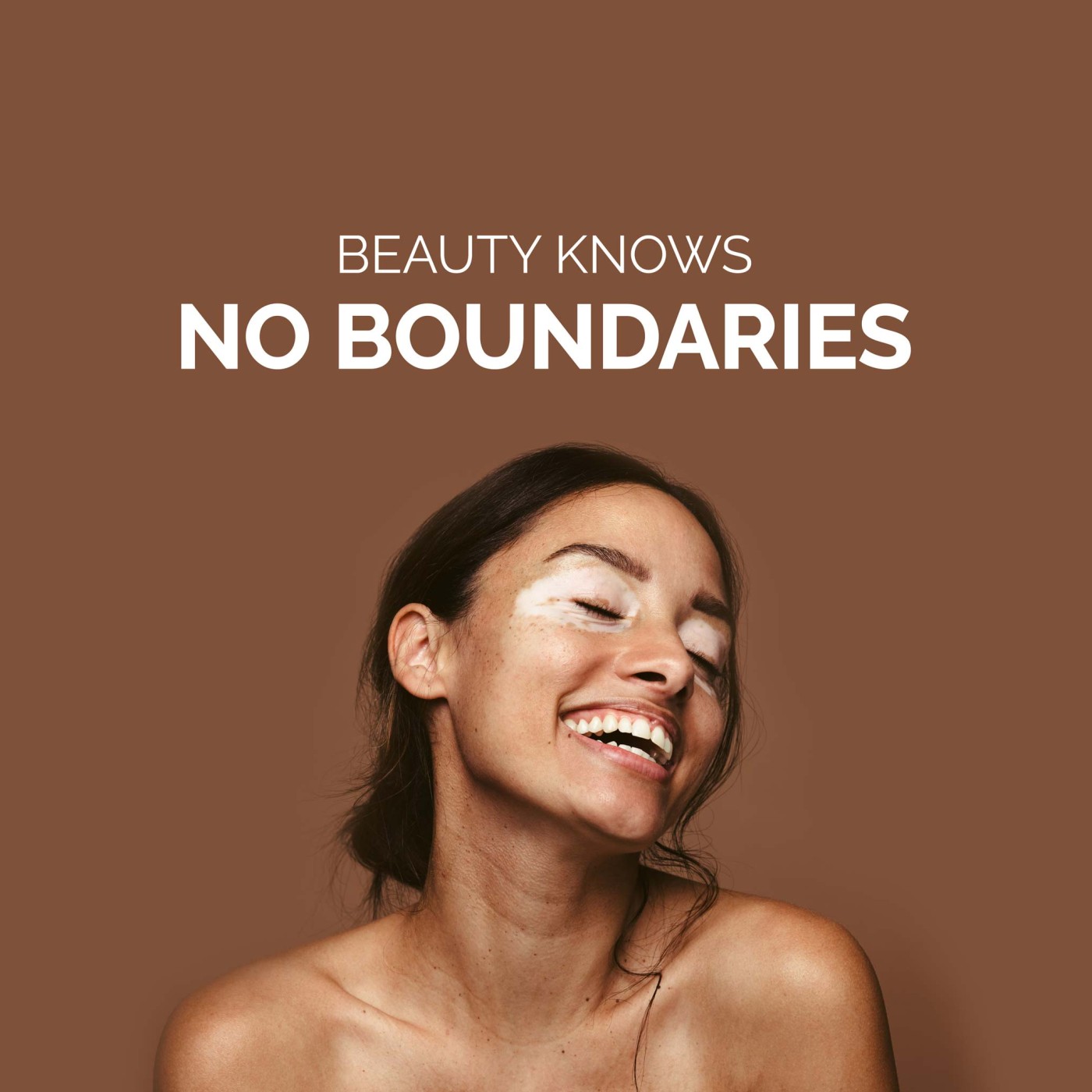 No boundaries hero image